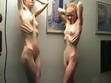 Anorexic Girls Posing Nude